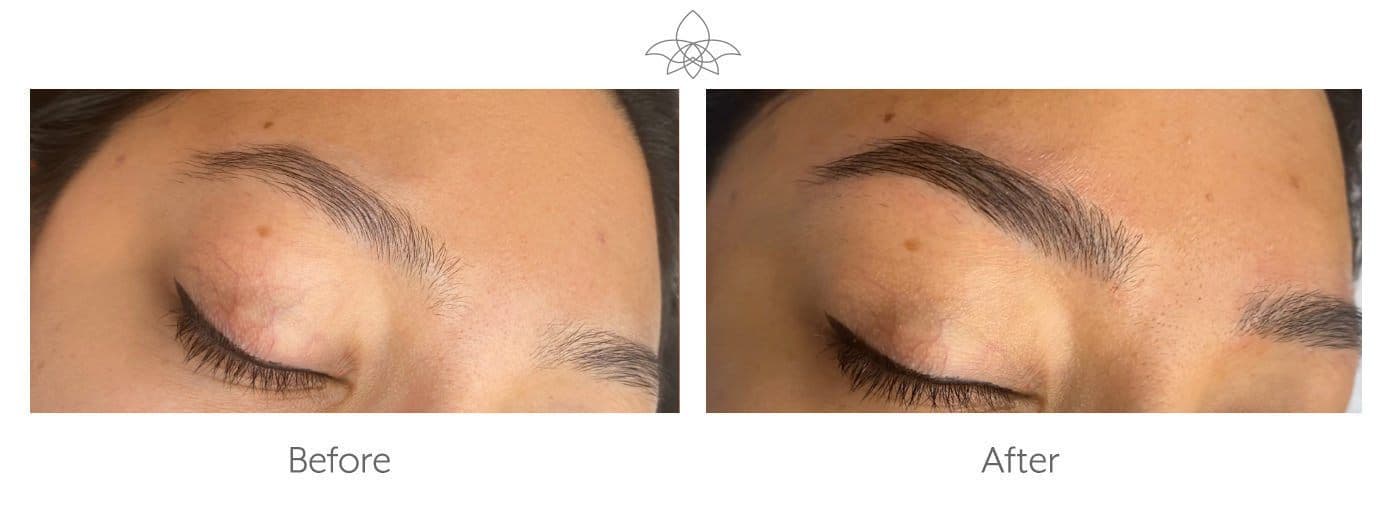 Microblading for Eyebrows