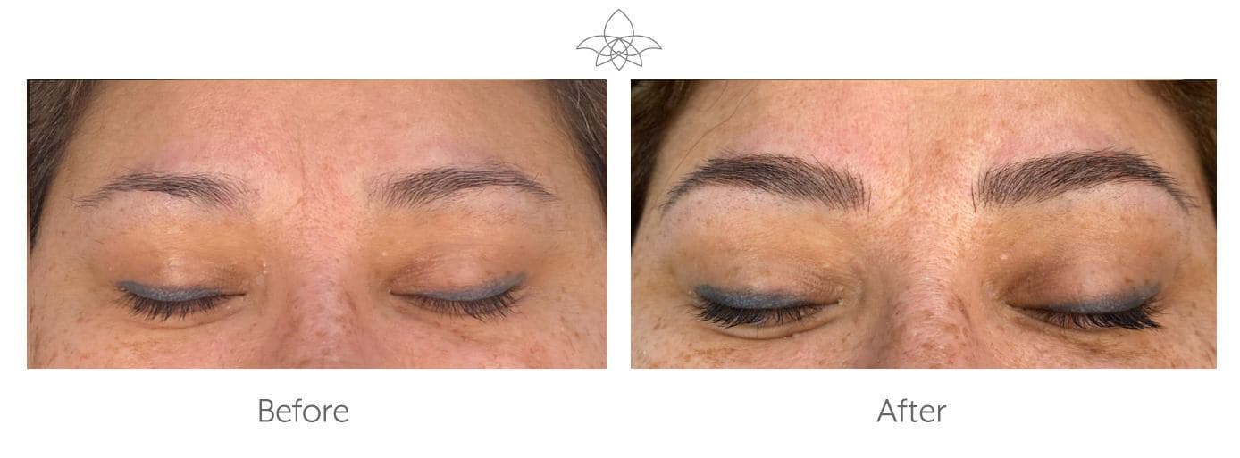 Microblading for Eyebrows