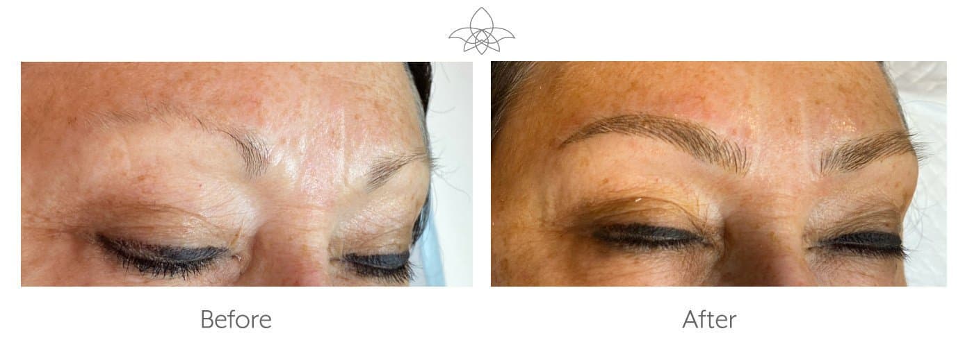 Microblading for Eyebrows