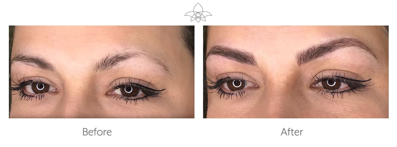 Microblading for Eyebrows