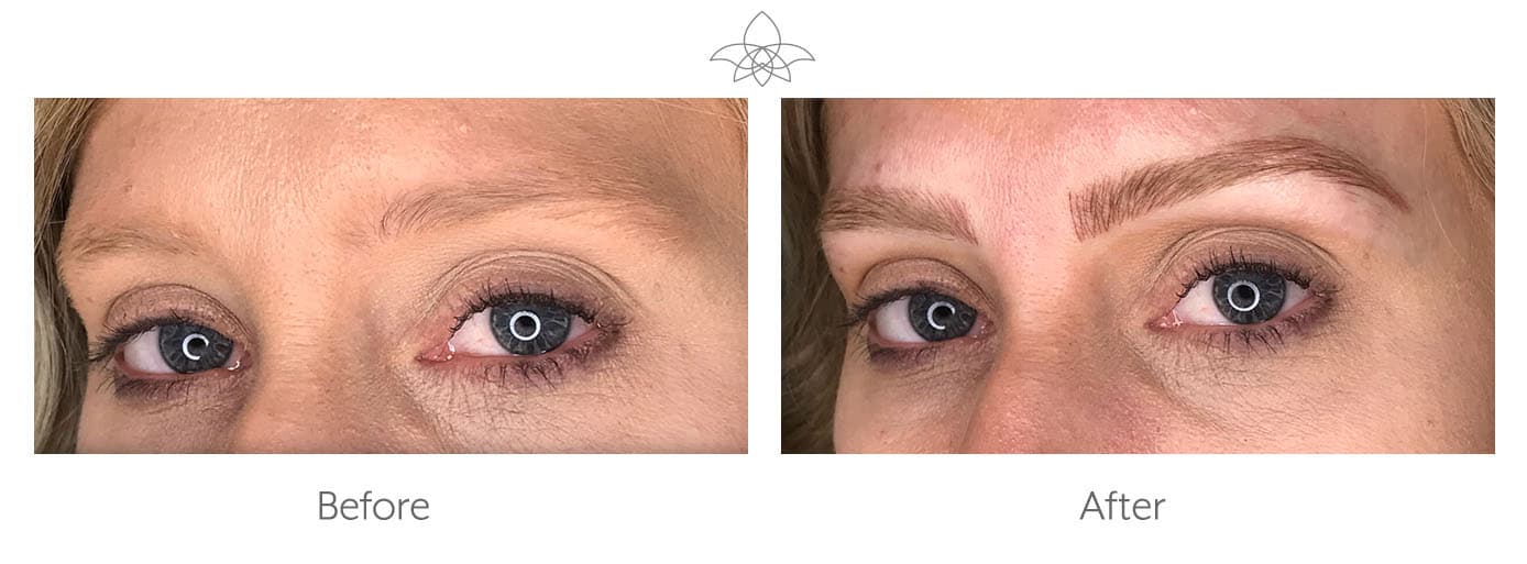 Microblading for Eyebrows