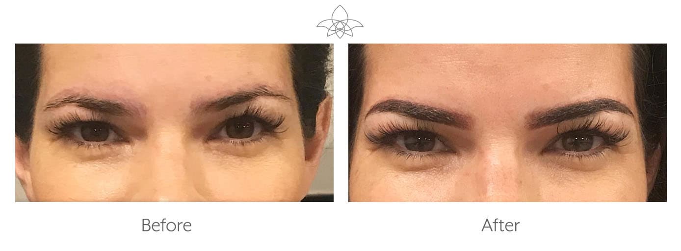 Microblading for Eyebrows