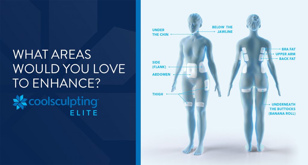 Coolsculpting Areas to Enhance Diagram